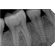iview-dental-intraoral-sensor-trident-2