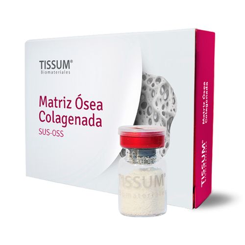 matriz-osea.jpg